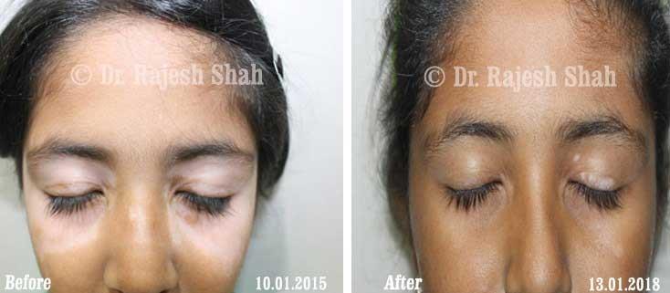 lifeforce homeopathy case-photos